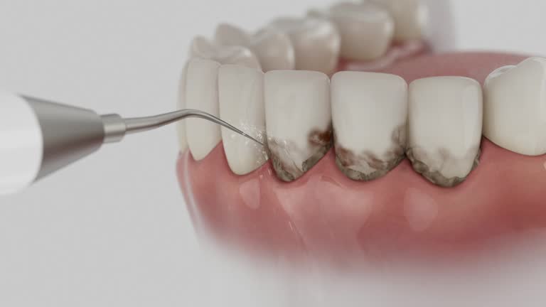 Trusted Emergency Dentist service in Ballville, OH - Dentist Open Now